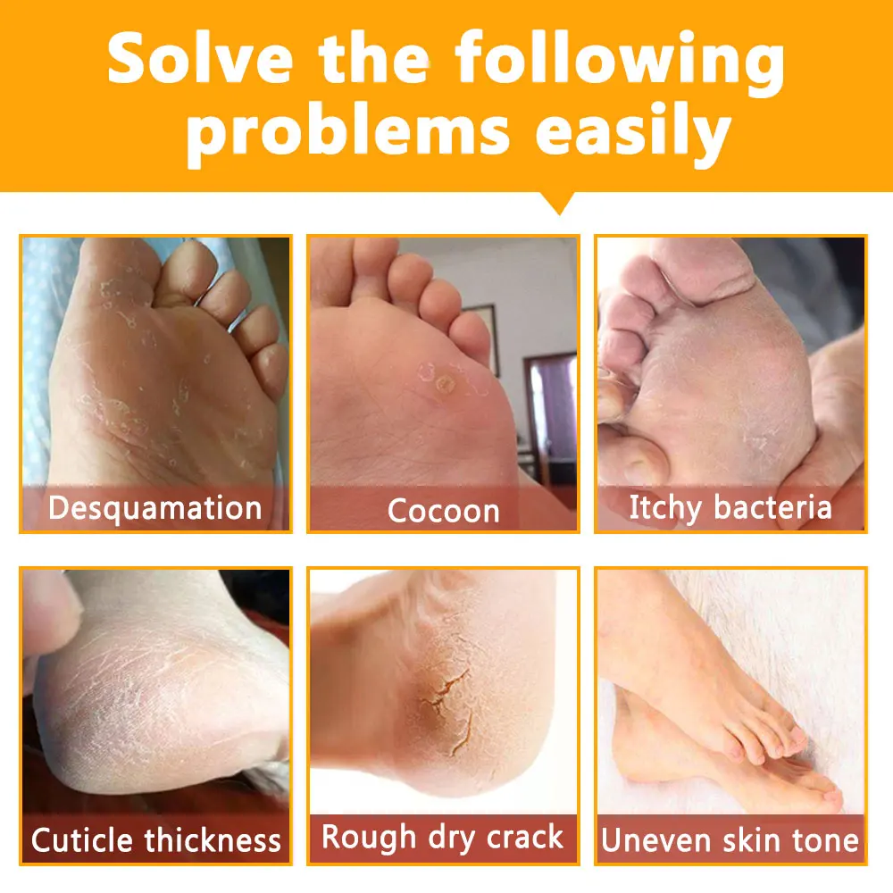 OEM Wholesale Top Feet Treatments Natural Vegan Ginseng Exfoliating Peeling Foot Care Mask