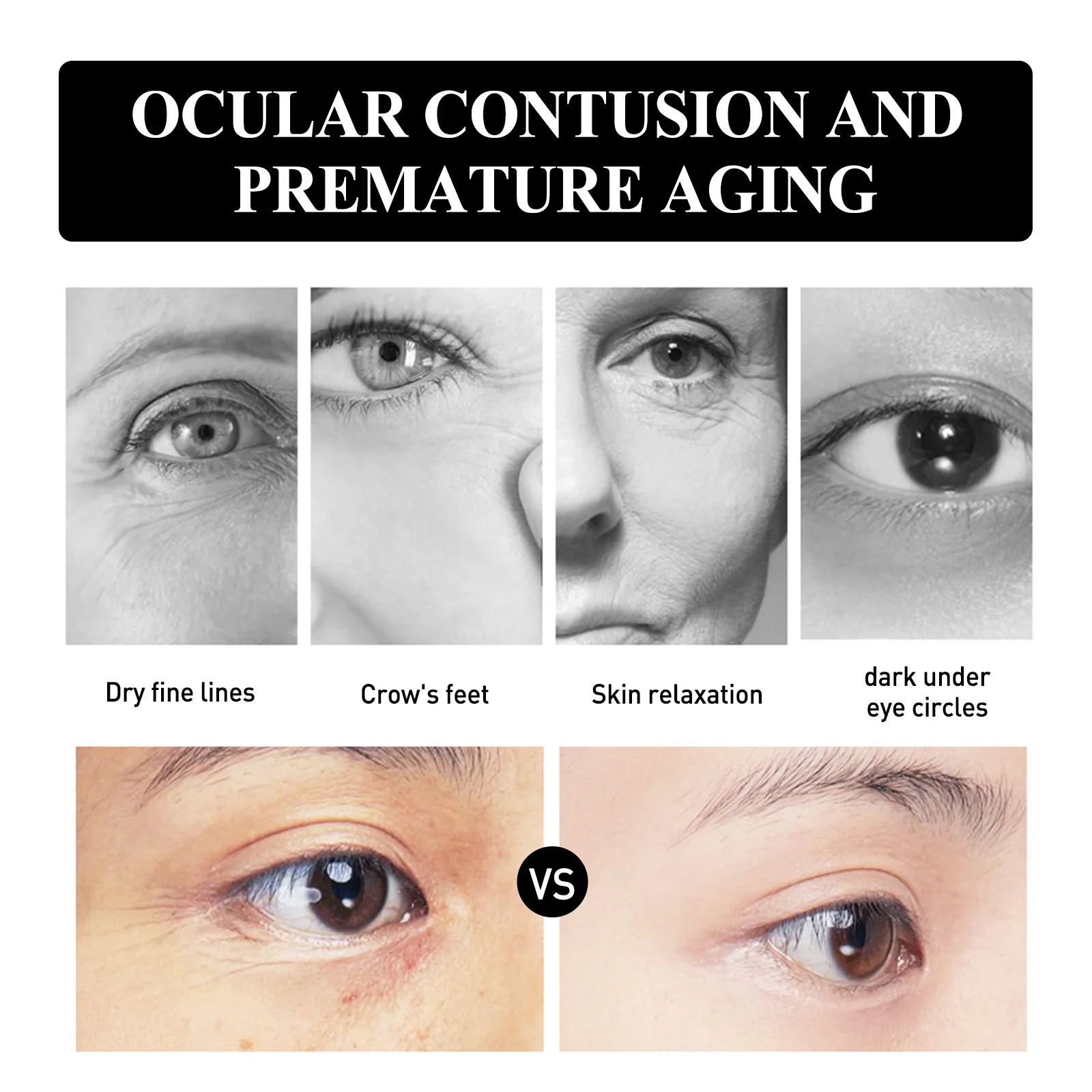 Snake venom peptide radiant moisturizing eye cream hydrating moisturizing lightening eye corner fine lines eye cream