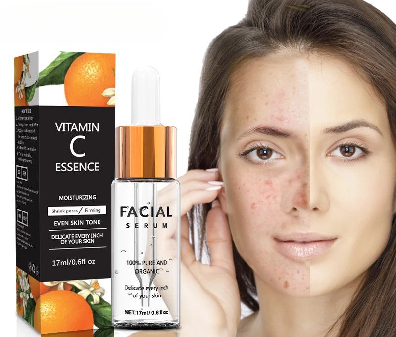 VC essence moisturizing lotion essence repairing skin facial care vitamin C original solution