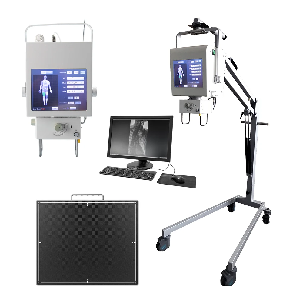 NEW hot-selling 5.3 KW Portable radiology X ray machine human vet digital