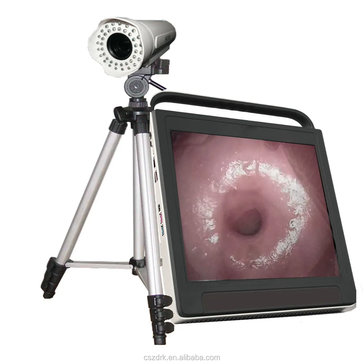 HD digital video colposcope for gynecology colposcopy for vagina