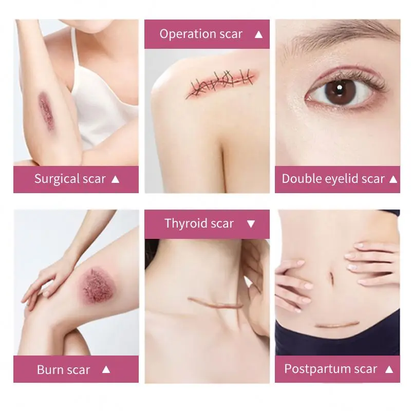 Wound treatment cream skin care women vitamin c cream for face anti wrinkle face cream