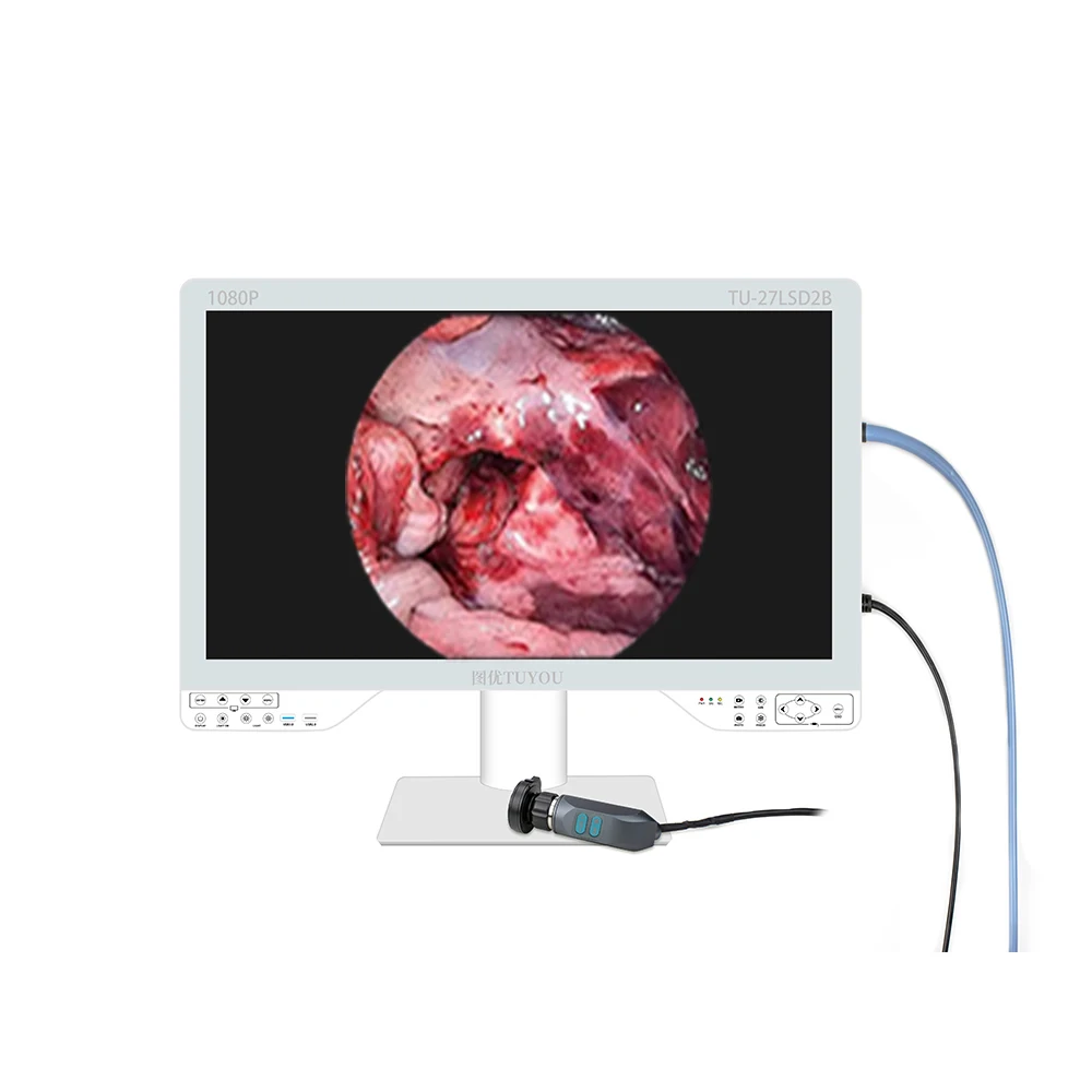 HD Video Endoscope Imaging System with 27-Inch Screen and LED Light Source Integrated Endoscope for Rigid & Flexible lens
