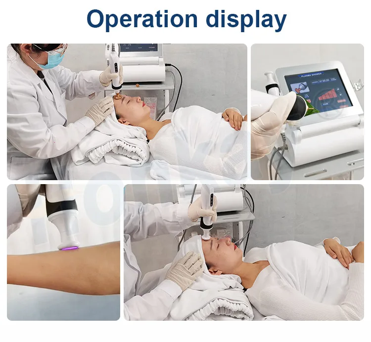 Professional cold jet plasma Pen Medical plasma Lift Pen Fiberblast plasma Pen