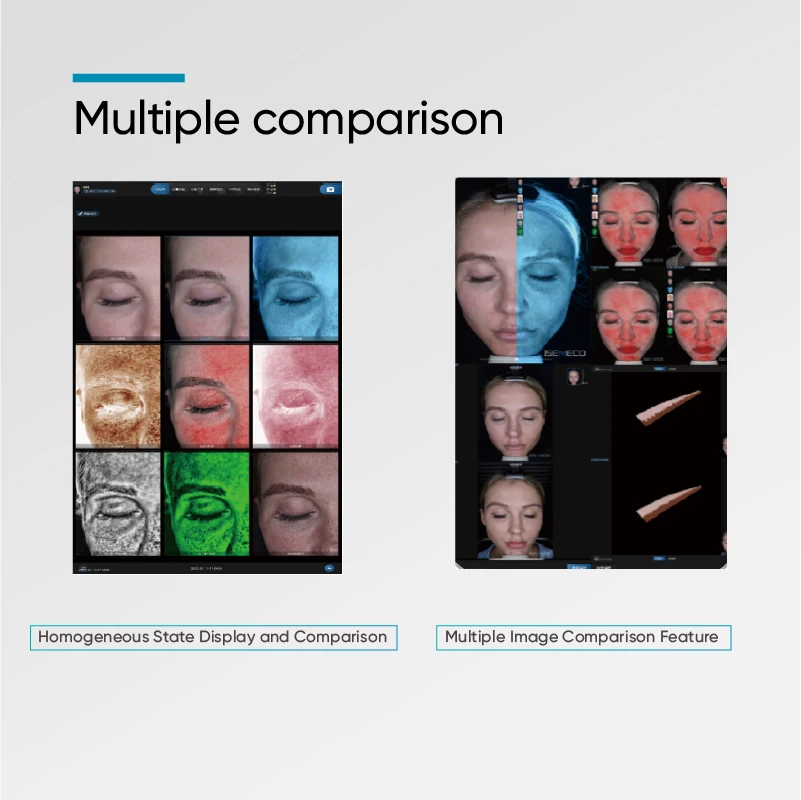 MEICET S7 AI 3D Face Skin Analyzer Detector Scanner Tester HD Images Beauty Aesthetics Dermatology Cosmetology Beauty Salon