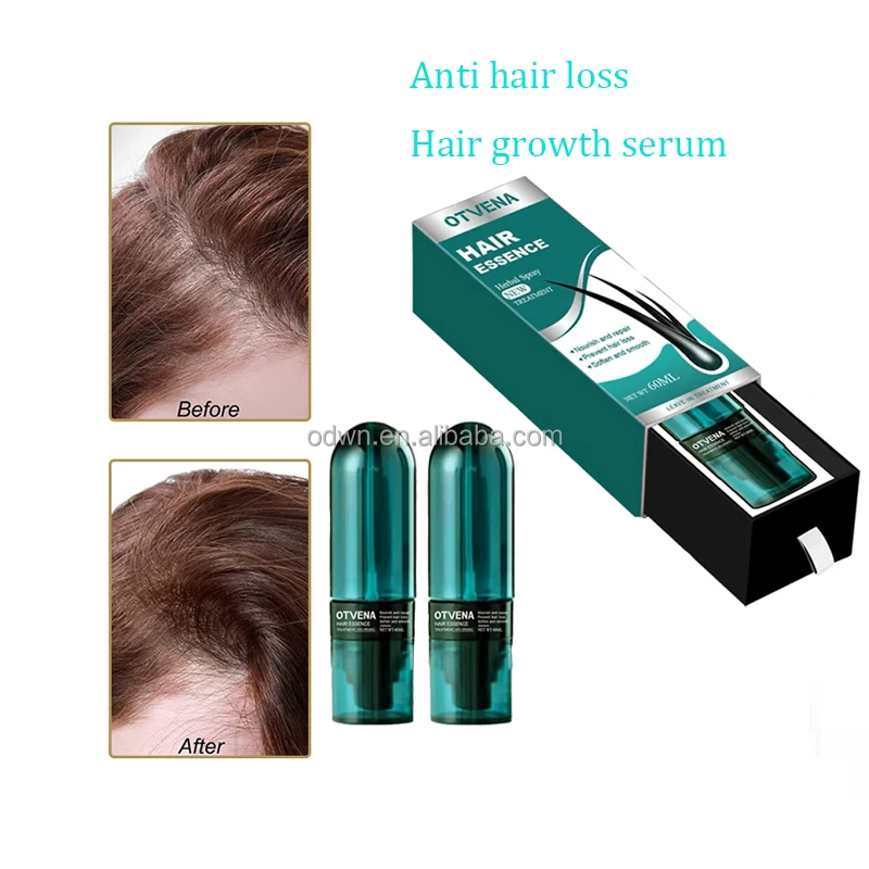 Otvena human hair care smooth promote hair growth reduce hair loss serum spray