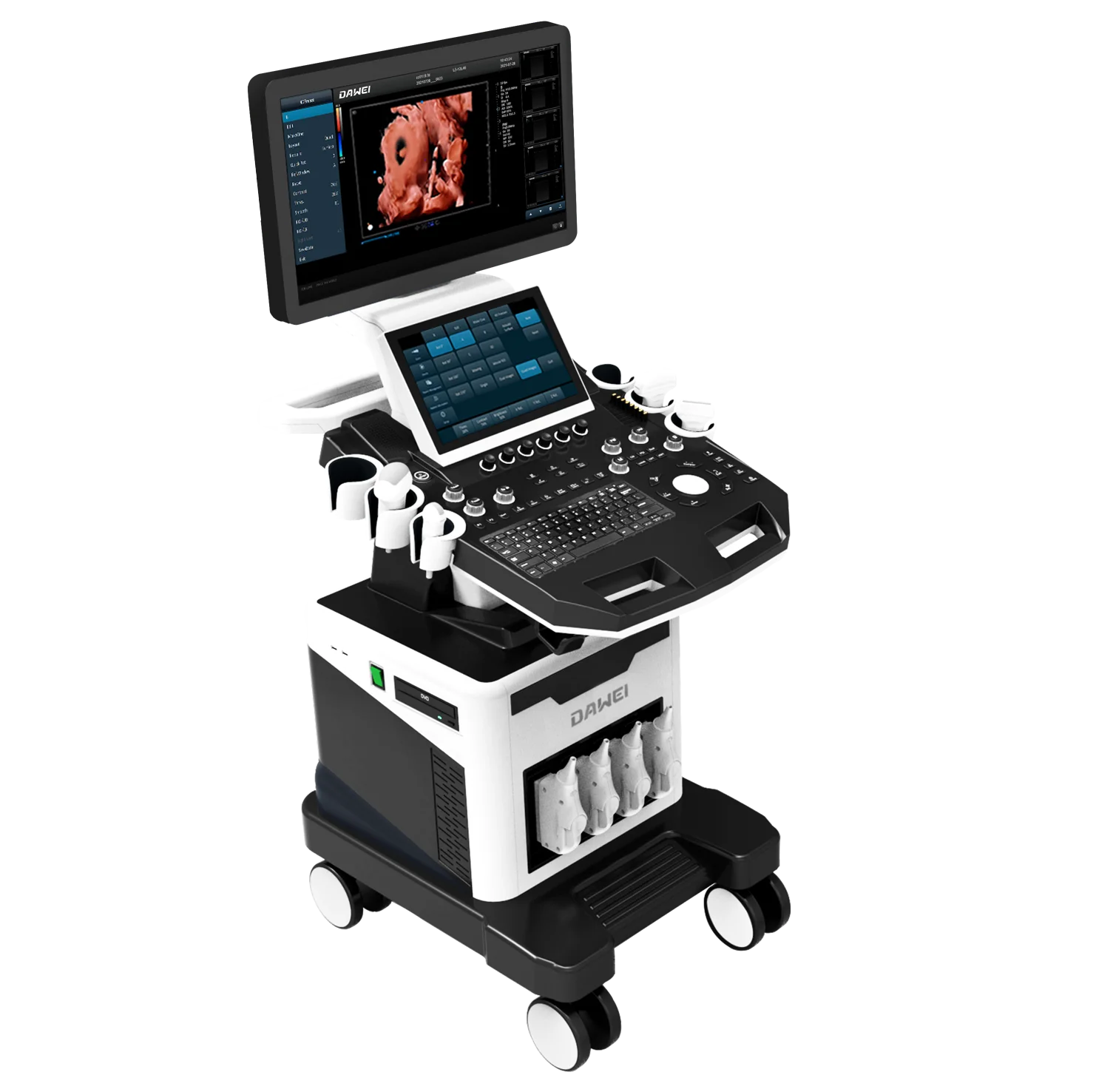 Обследование Ob/Gyn, экологичный Цветной Допплер, медицинское ультразвуковое оборудование Sonoscape с 5D визуализацией