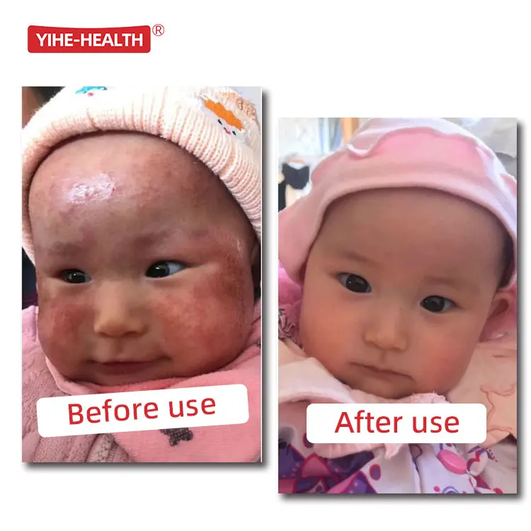 YIHE-HEALTH крем для восстановления кожи пеленки сыпь экзема у