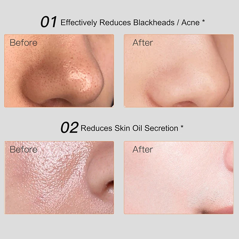Factory Wholesale OEM ODM Mineral Volcanic Mud Mask Blackhead Remover For Face