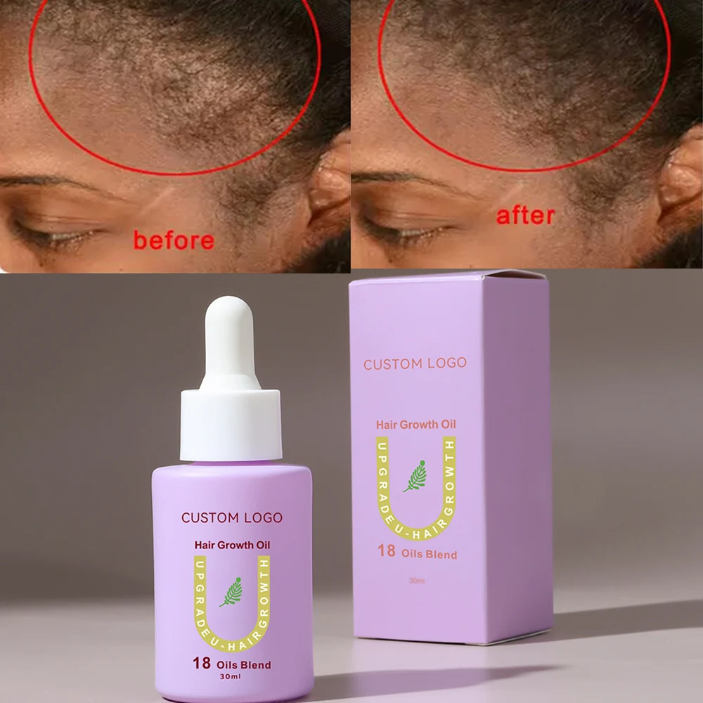 Factory OEM Rosemary Onion Custom Logo Hair Growth oil Peppermint Olive Oil Hair Treatment Oil Organic Manufacturer