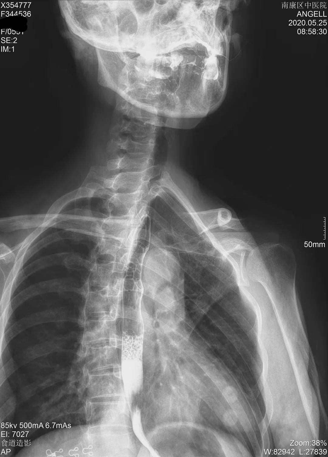 Konida medical dry film , agfa dt2b xray camera