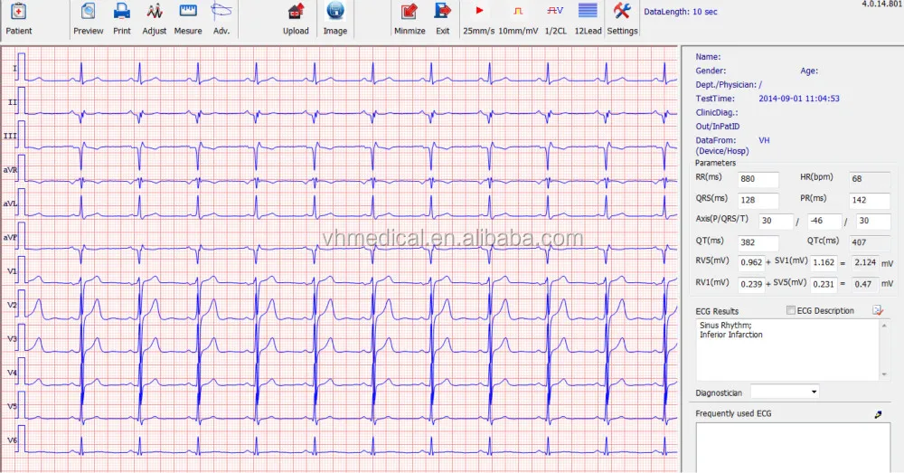 trending products 2024 new arrivals medical science 12-Lead pc based mobile digital ecg system from China