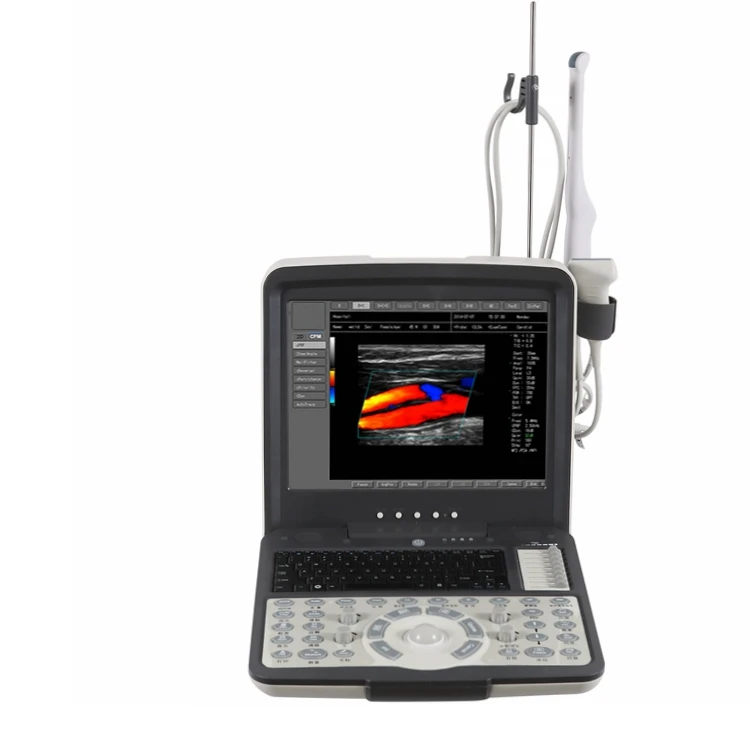 Цветной Допплер для ноутбука, ультразвуковой сканер, экономичная модель, специализирующаяся на акушерской и гинекологической сфере