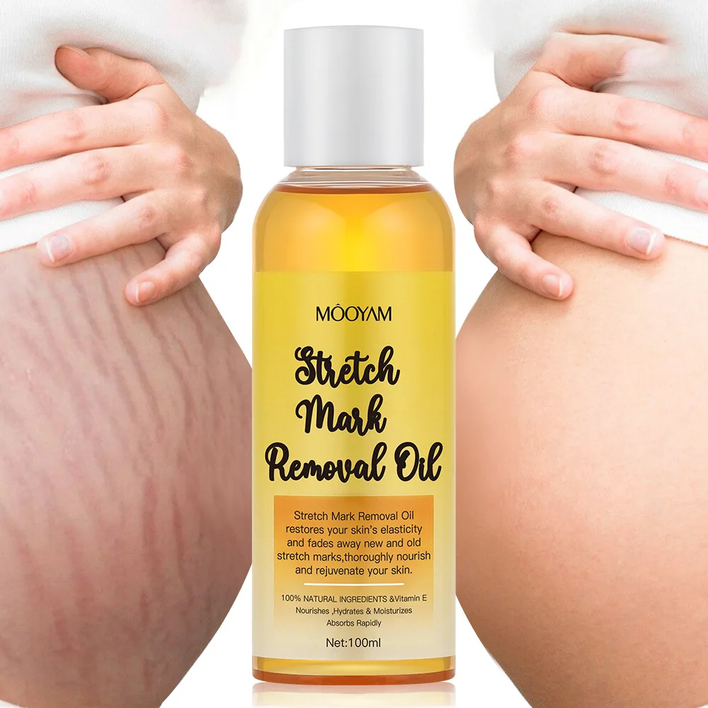 MOOYAM Organic Stretch Mark Removal Oil Treatment Repair Anti Pimples Acne Scar Removing Tummy Tuck Massage Oil DHL