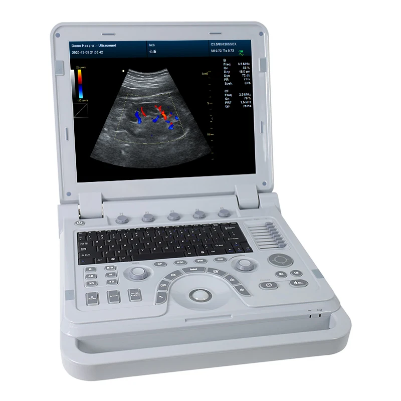 CONTEC CMS1700B 3D 4D colour doppler ultrasound scanner ultrasound price