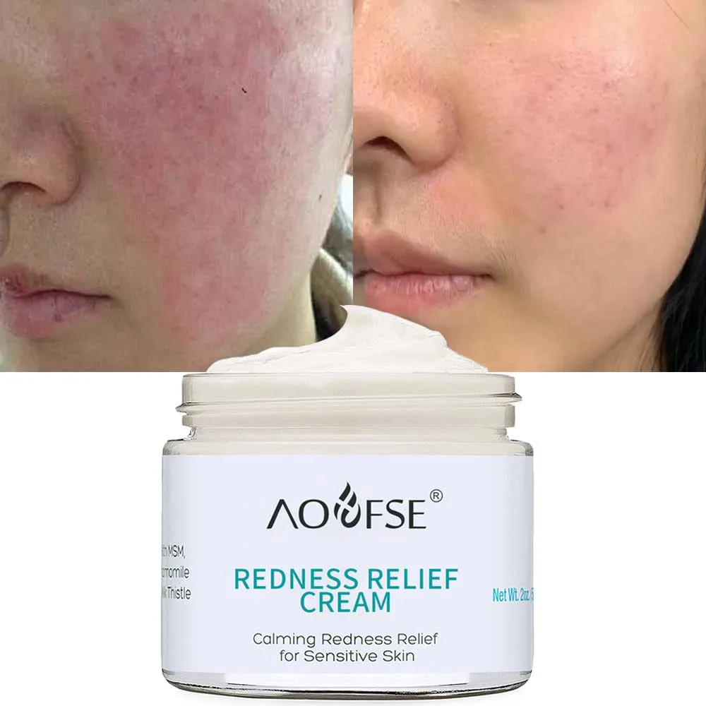 Private Label Sensitive Skin Calming Soothing Redness Relief Face Cream Moisturizer for Dry Skin