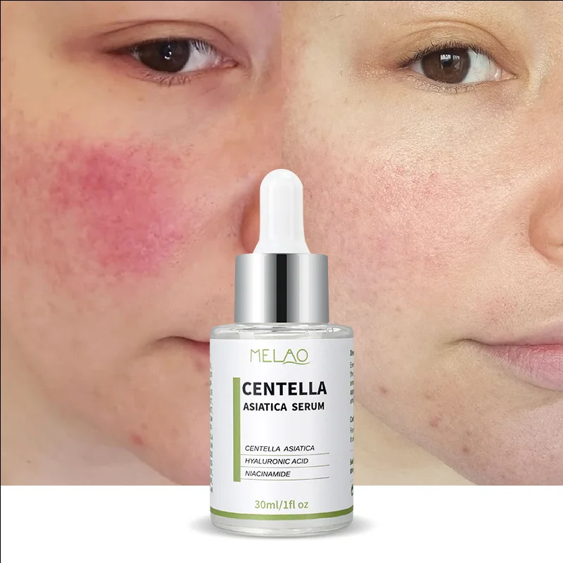 Custom Logo Rapid Soothing Skin Repair Oil Skin Face Serum Sebum Rebalancing Rx 131 Ampoule Minimize Sebum Serum