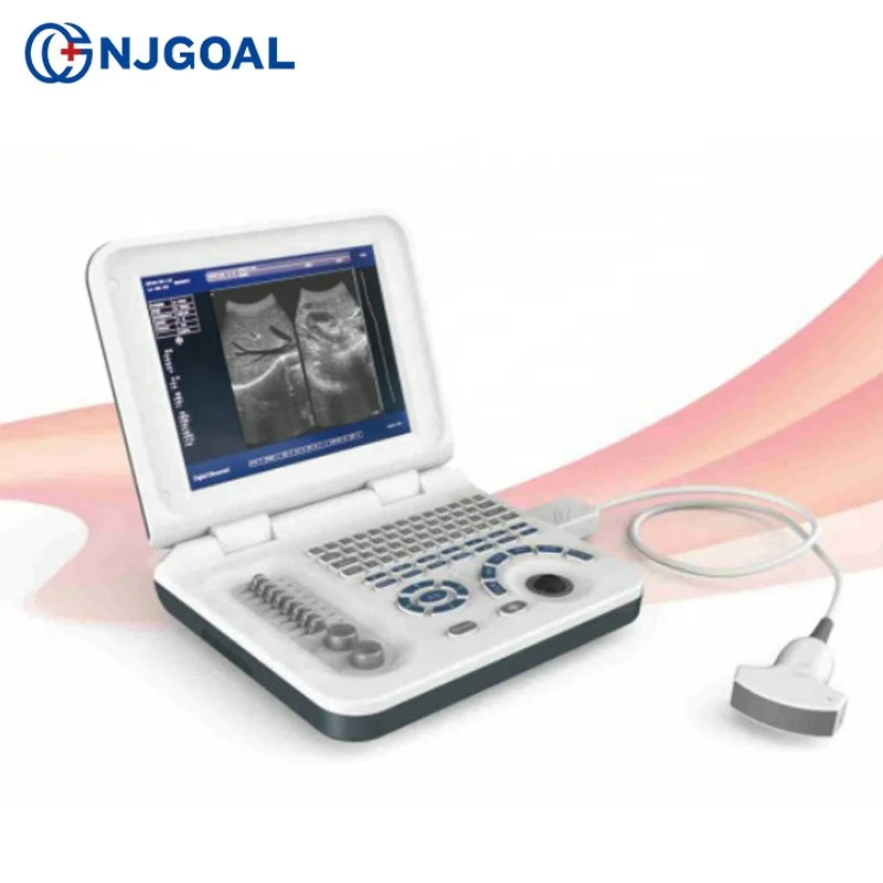 Новый продукт запуск в Китае беременность недели измерения полный цифровой 3d ультразвуковая машина цена