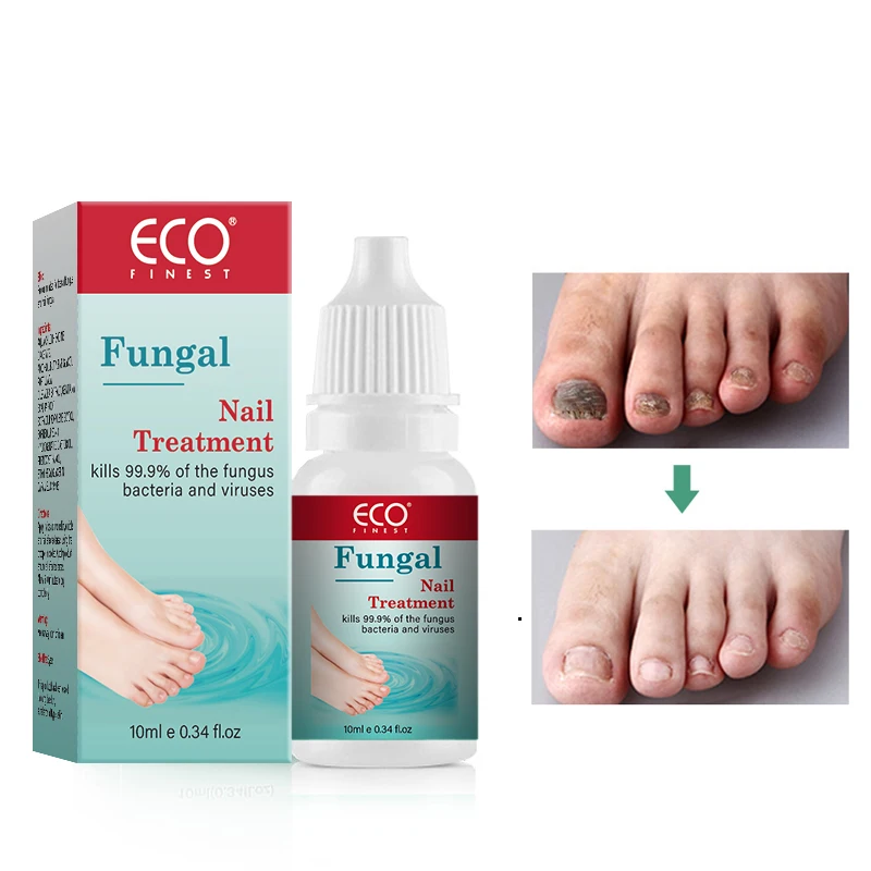 Foot Care Best Treatment Fungus Infection Remedies Liquid Toe Nail Fungus Treatment Fungal Nail Repair -281151