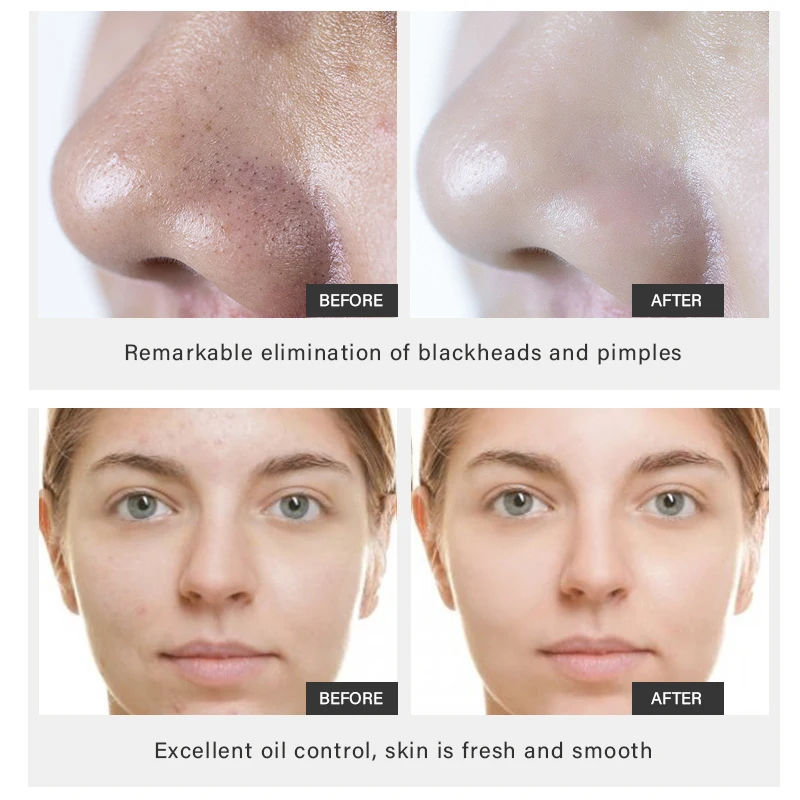 Facial Volcanic Mud Mask Pores Shrinking Moisturizing Deep Cleansing Dead Skin Removing 150ml MOOYAM Volcanic Mud Cleansing Mask