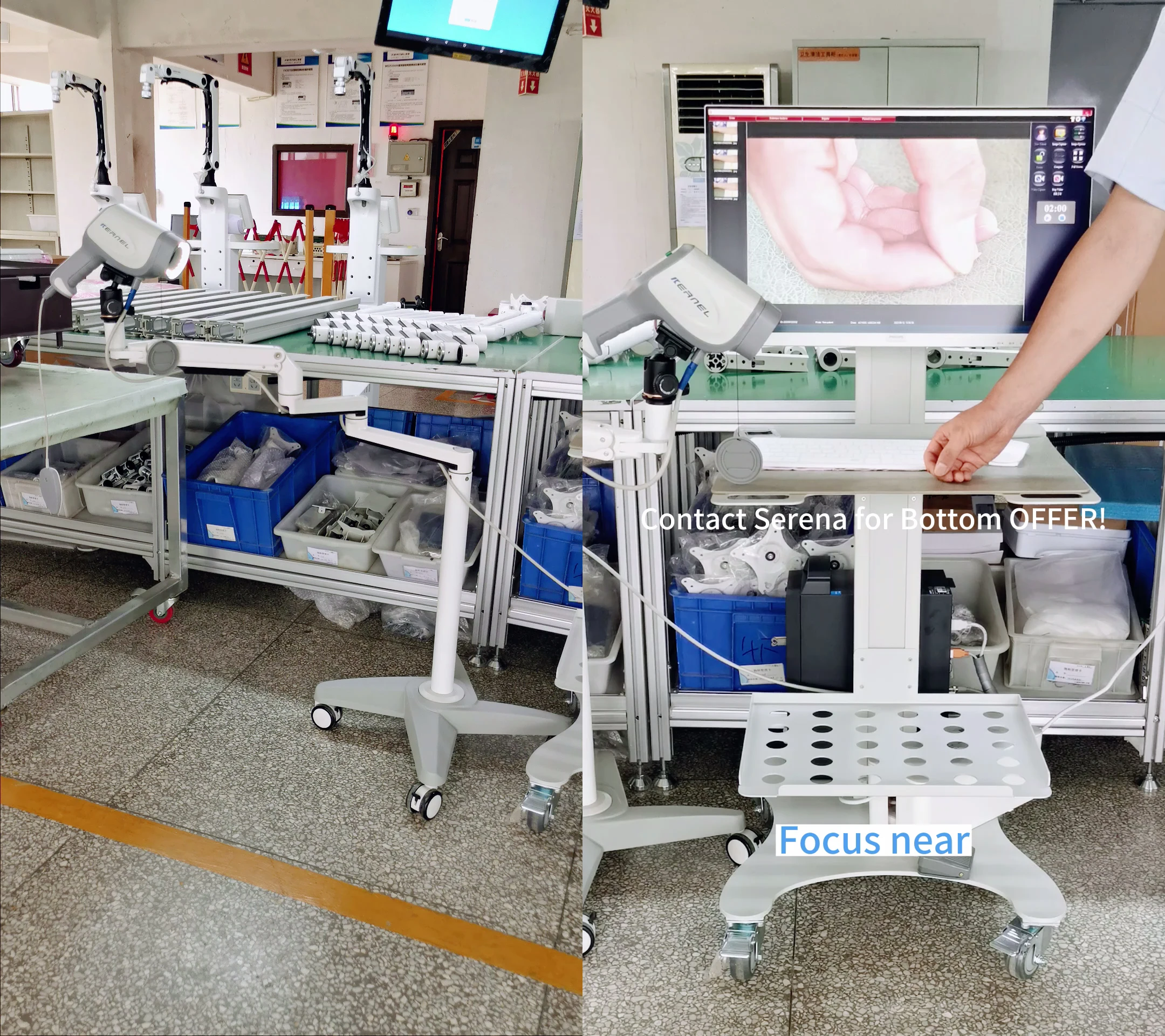Digital video camera colposcopio kernel medical HD Optical digital Colposcope kn-2200a for gynecology cervical cancer prescreen