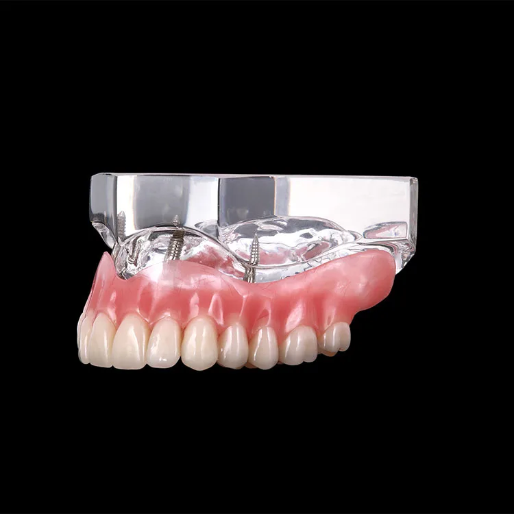 teeth model (3).jpg