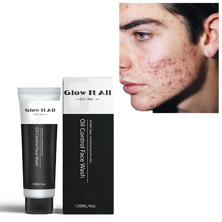 Оптовая продажа частная торговая марка Глубокая очистка контроль жирности удаление черных точек акне средство для очистки лица веганов моющее