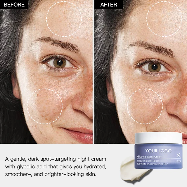 Private Label Skin Renewing Papaya Enzymes Reducing Dark Spots AHA Face Anti-Aging Night Cream For Whitening Face And Dark Spot