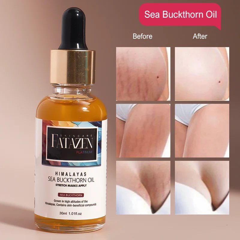 Private Label Skincare Aloe Vera Massage Essential Oil For Improve Skin Elasticity OEM Pure Sea Buckthorn Oil For Stretch Mark