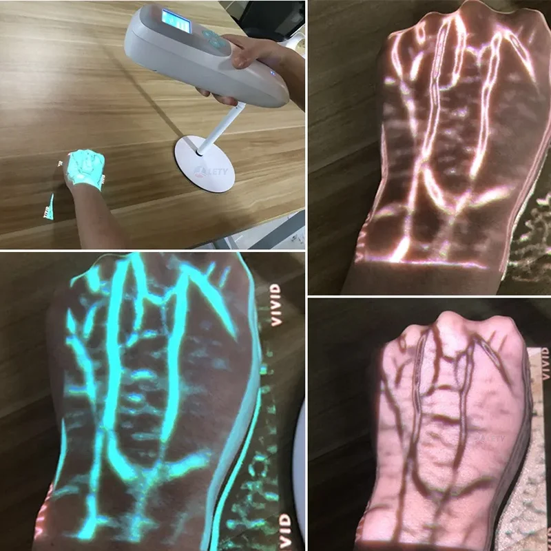 Factory Price Portable Medical Infrared Vein Viewer Finder Machine For Finger Vascular Blood Detector Vascular Imager