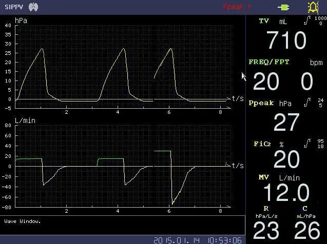 medical equipment manufacturer wholesale icu ventilator with air compressor