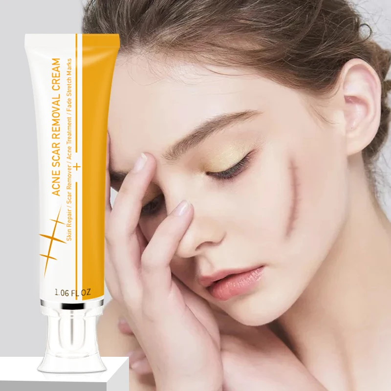 Private Label Pimples Stretch Marks Remove Face Gel Tummy Tuck Tightening Stretch Mark Removal Cream Acne Scar Removal Cream