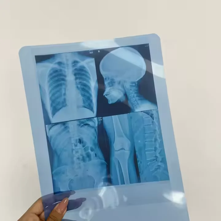 Factory price hot sale Inkjet Blue Medical dry film transparent blue X-ray film for CT DR MRI Radiological device