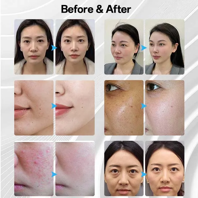 Portable High Oxygen Oxgen Jet Oxgen Facial Machine With 7-color LED light Mask Skin Care jet peel dome oxygen facial machine