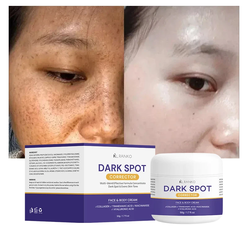 OEM Private Label Dark Spot Removal Facial Cream Whitening Freckle Face Cream Soft Delicate Skin Smoothing Brightening Skincare