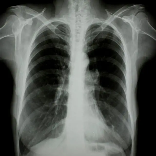 Hot Selling White Opaque Laser Medical Film X-ray Film  for Laser Printers in Sheets