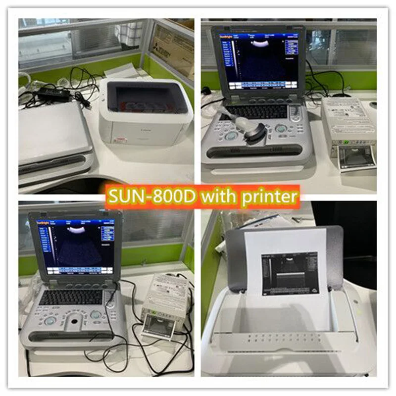 SUN-800D Manufacturer Hospital device Ultrasound Machine 3D diagnostic Scanner ecografo portatil Laptop BW Vet ultrasound
