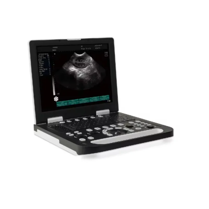 Sonoscape Portable Laptop 2D 3D 4D Color Doppler Ultrasound Scanner Machine for Veterinary and Human
