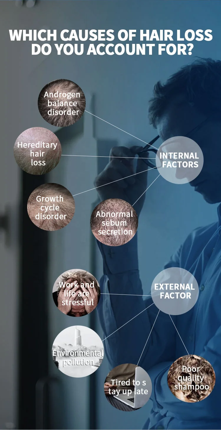 Сыворотка для роста волос, уход за волосами, жидкость для мужчин