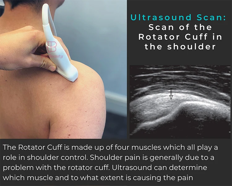 Portable Site-rite Ultrasound Scan 3D 4D Full Digital Medical Ultrasonido Portatil Hospital Diagnostic Laptop Machine