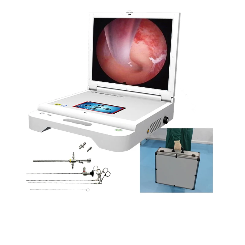 shrek endoscopy portable medical endoscope camera shrek sygw605 prix