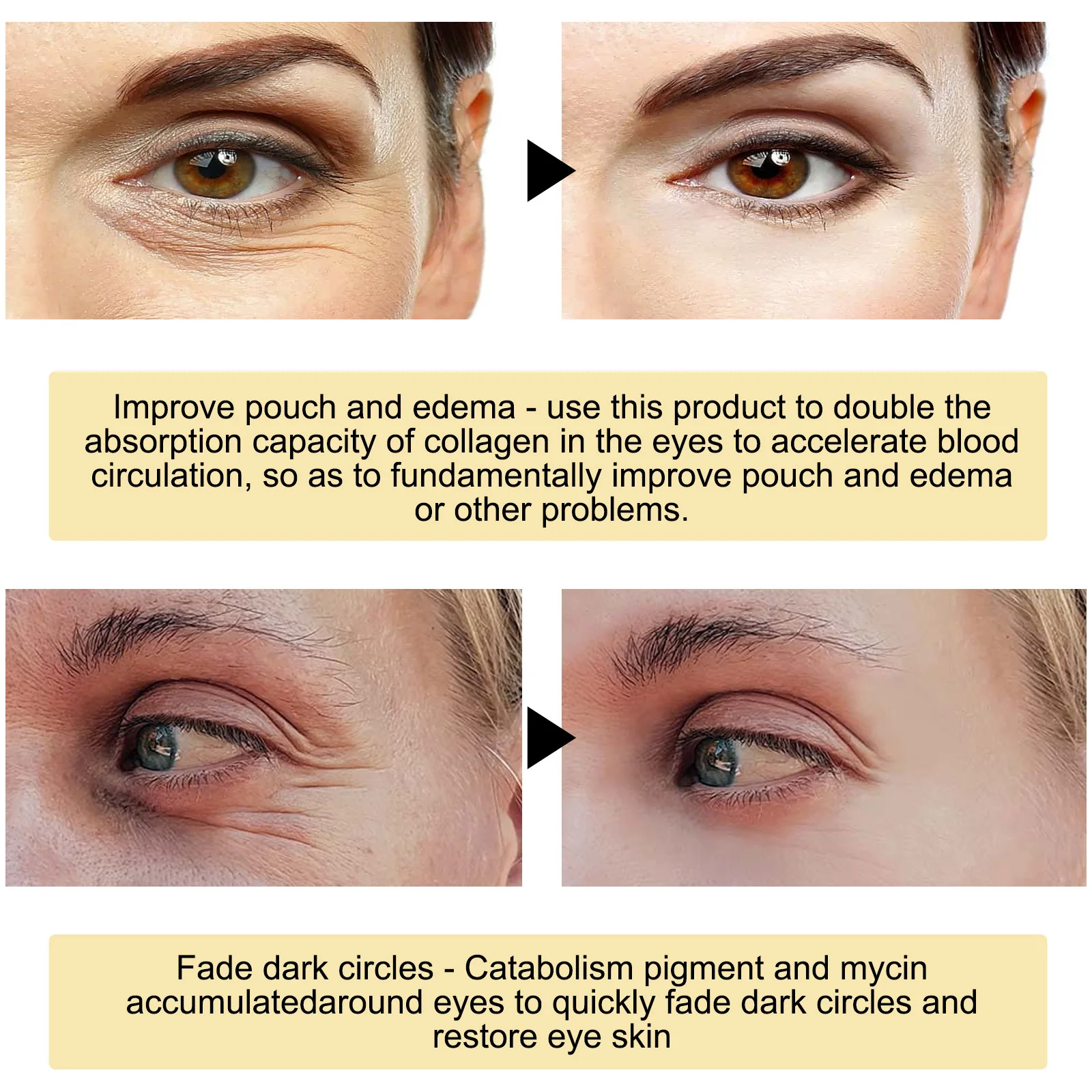 EELHOE 24K Golden Eye Mask to lighten eye bags, tighten, moisturize and lift fine lines at the corners of the eyes. Eye care