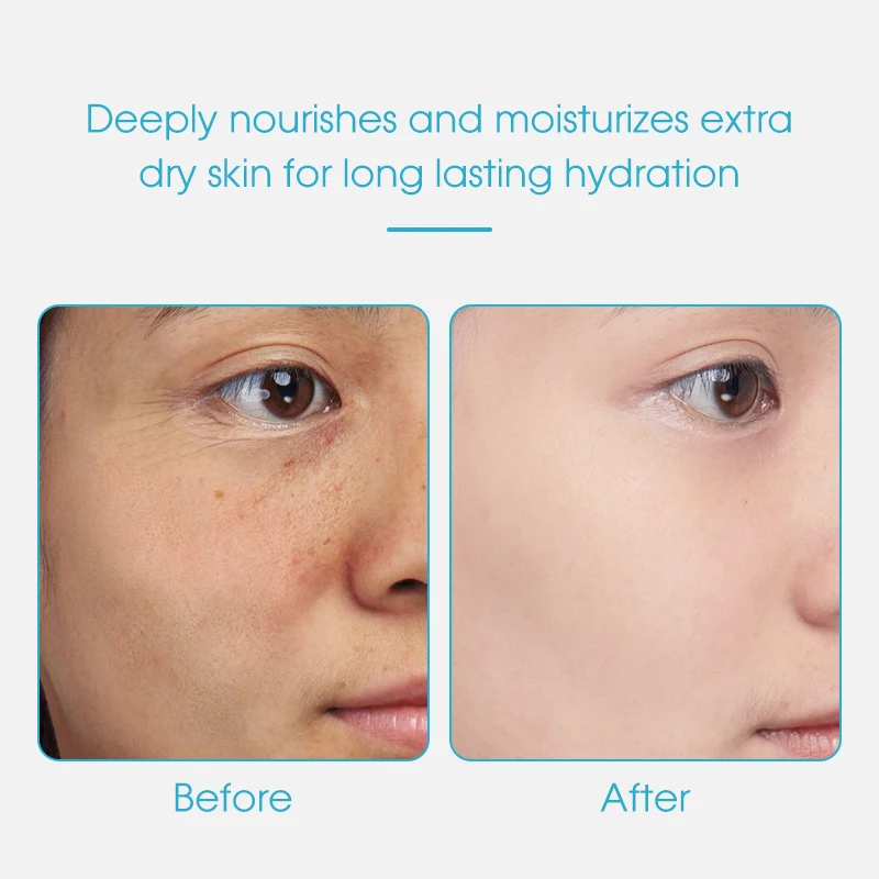 Chinese Night Cream Cruelty-free Moisturizing & Nourishing and Niacinamide & Centella Skin Whitening Lightning Night Cream