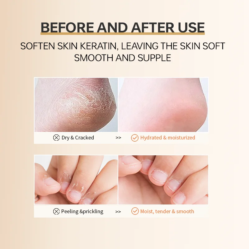 Exfoliating skin Vaseline hand and foot care cream factory OEM wholesale