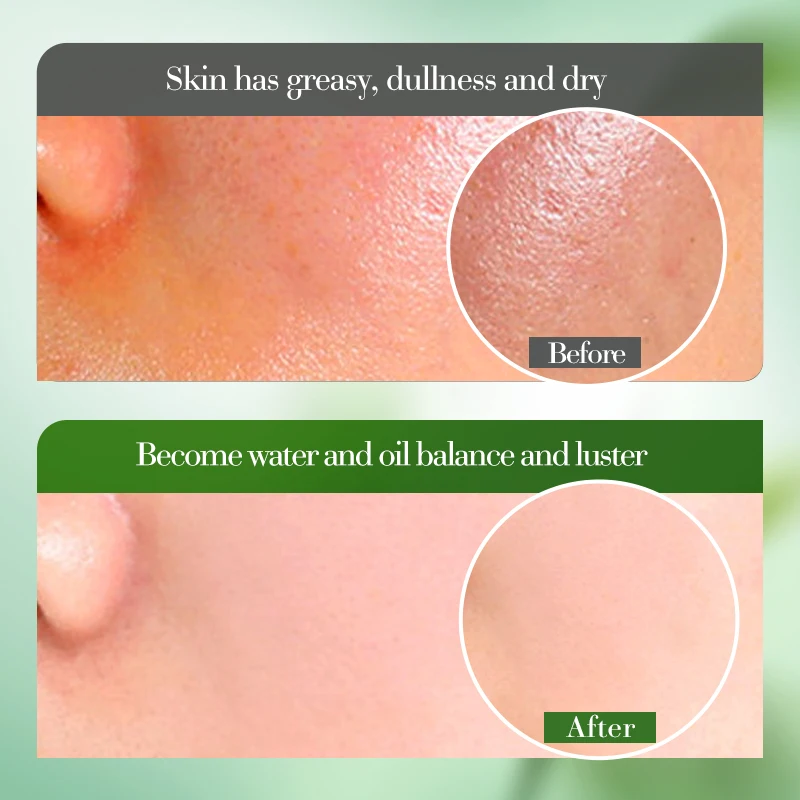 OEM ODM Private Label Beauty Products BIOAQUA Aloe Vera Hydrating Facial Lotion Nourishing Skin Brightens Lotion Repair Cream