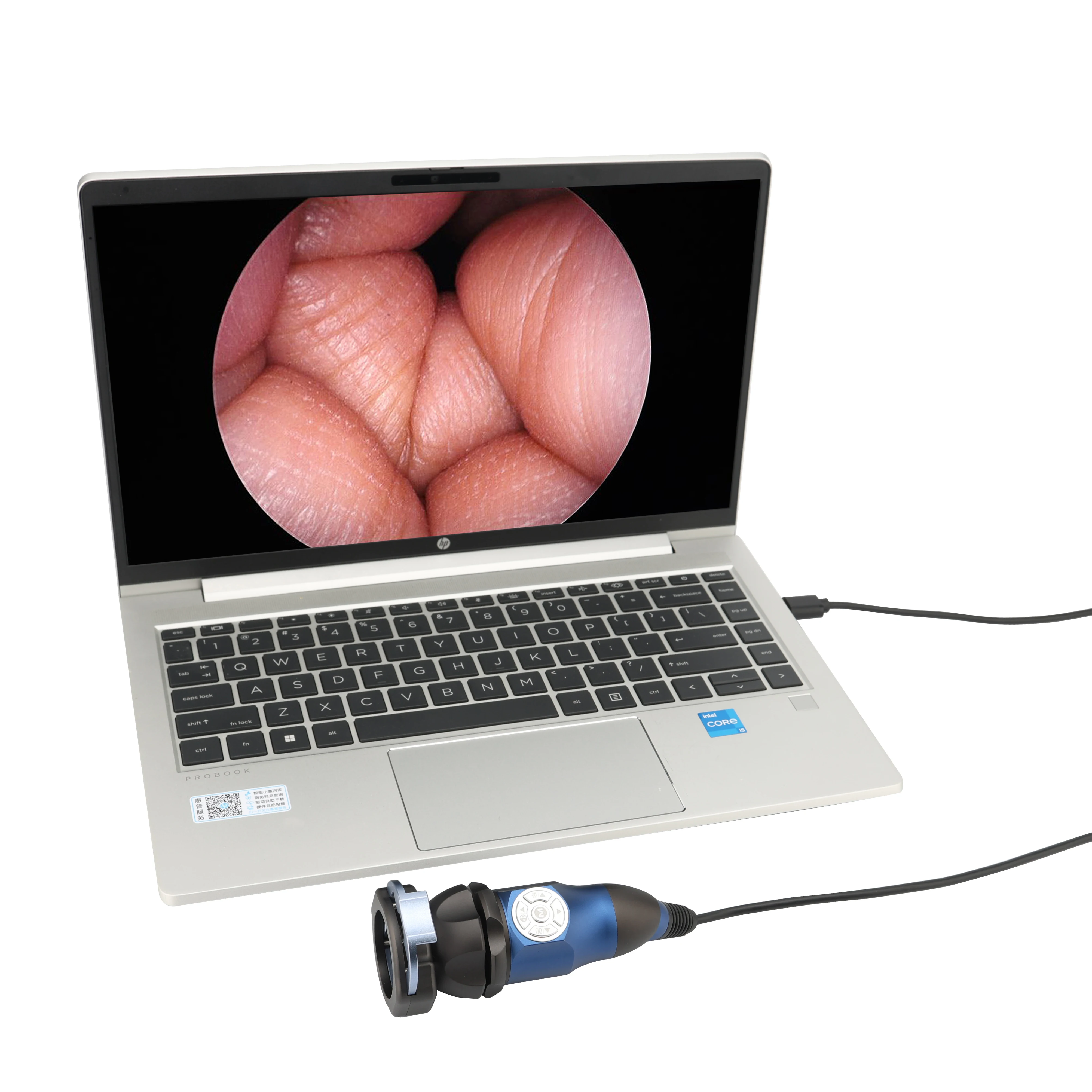 1080P USB full HD Endoscope Camera, HDMI Medical ENT Endoscope camera Portable Endoscope Camera