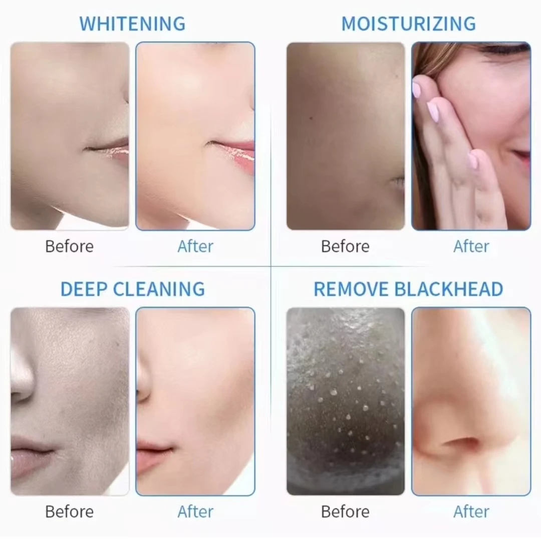 Aqua Clean Peeling Facial Solution S1 S2 S3 Serum Essence For Hydra Dermabrasion Skin Care Beauty Blackhead Wrinkle Removal