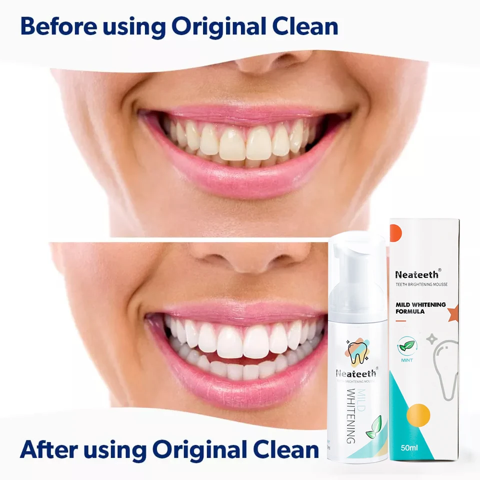 Hot Selling Stain Removal Aligner Retainer Cleaner Teeth Whitening Foam for Invisalign Dental Braces Mousse Toothpaste