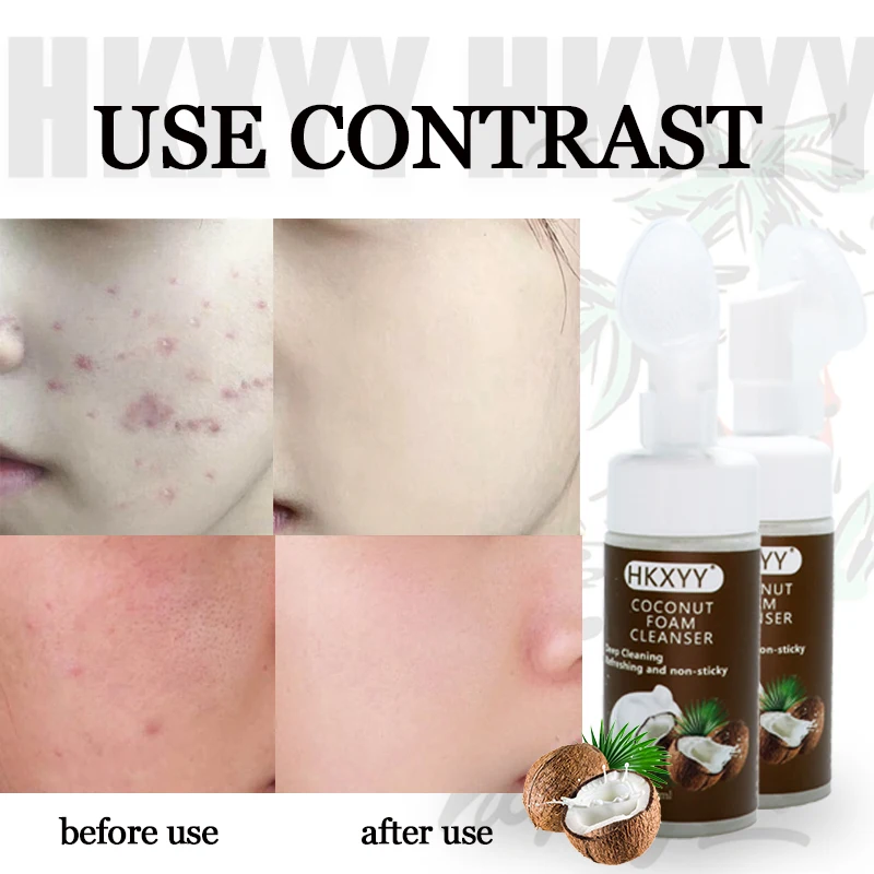 Private Label Customized Organic Face Wash Soothes and Brightens Skin Natural Vegan Coconut Foaming Foaming Cleanser