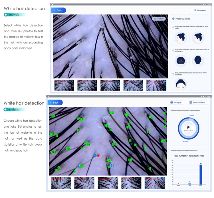 New Hair Scalp Scanner Energizer  Hair Growth Therapy Machine  Head Scalp Massage Scalp Analysis Hair Analysis Machine